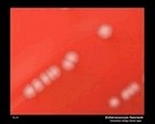 Enterococcus faeciumm